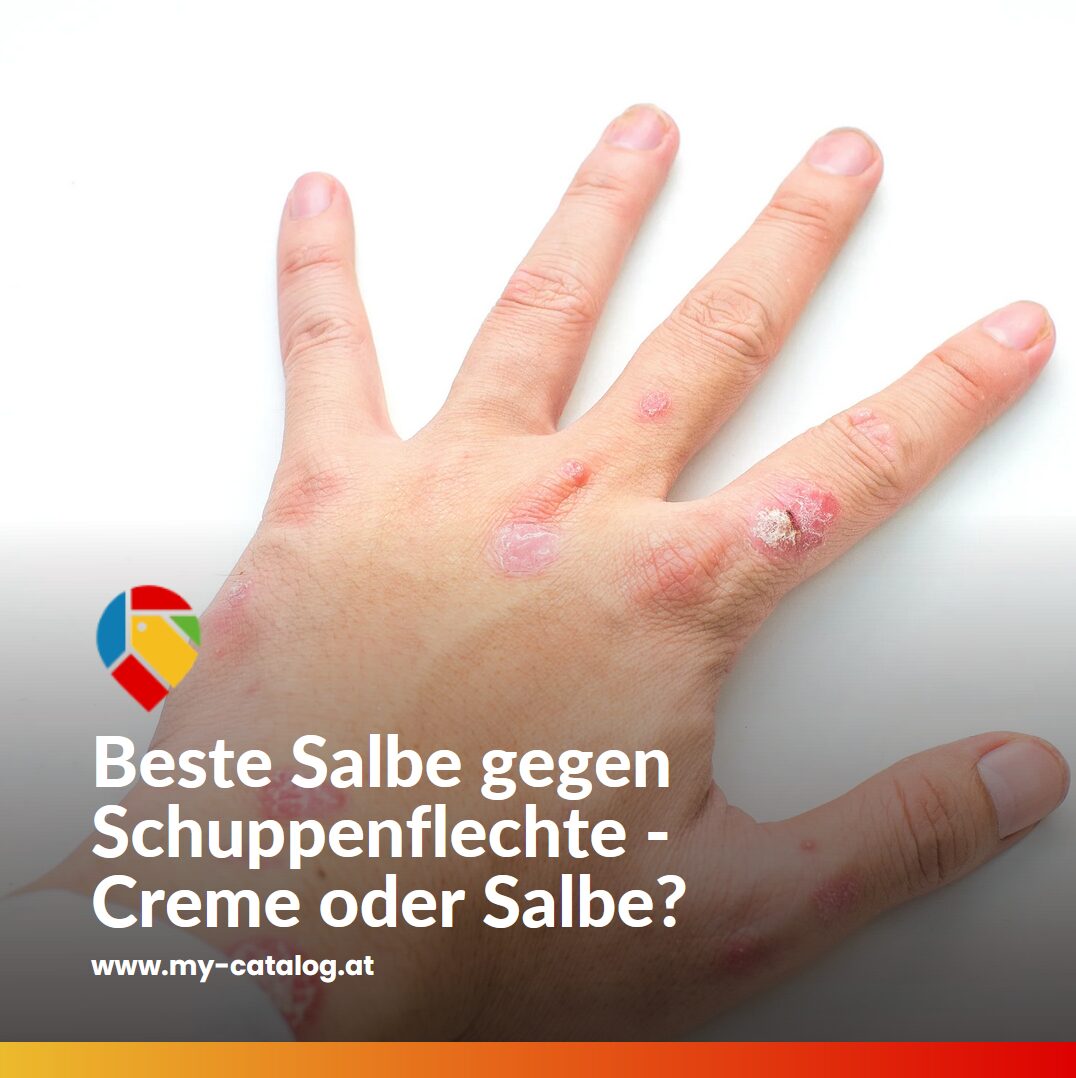 Beste Salbe gegen Schuppenflechte - Creme oder Salbe? Beste Salbe gegen Schuppenflechte - Creme oder Salbe?