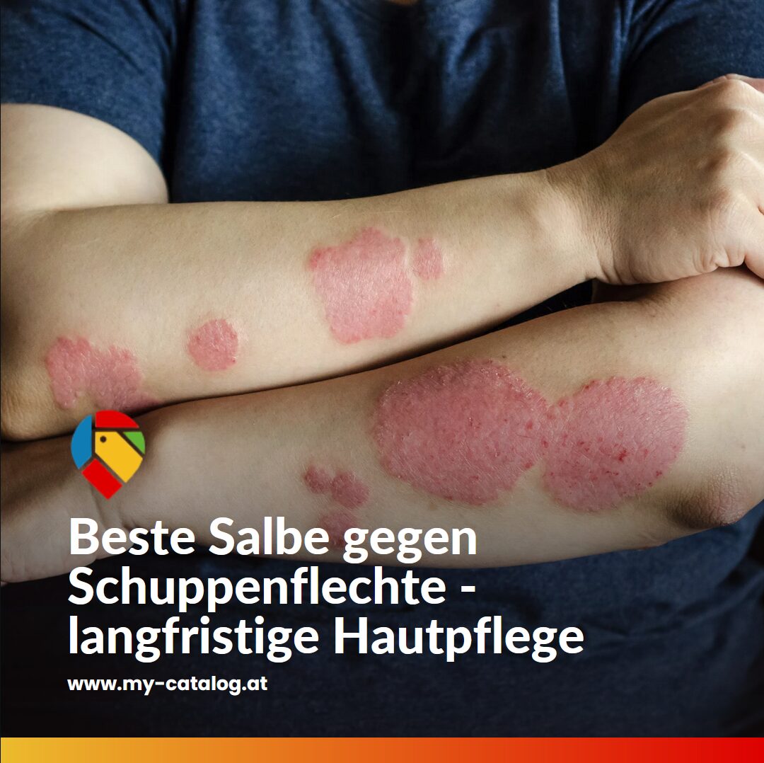 Beste Salbe gegen Schuppenflechte - langfristige Hautpflege Beste Salbe gegen Schuppenflechte - langfristige Hautpflege