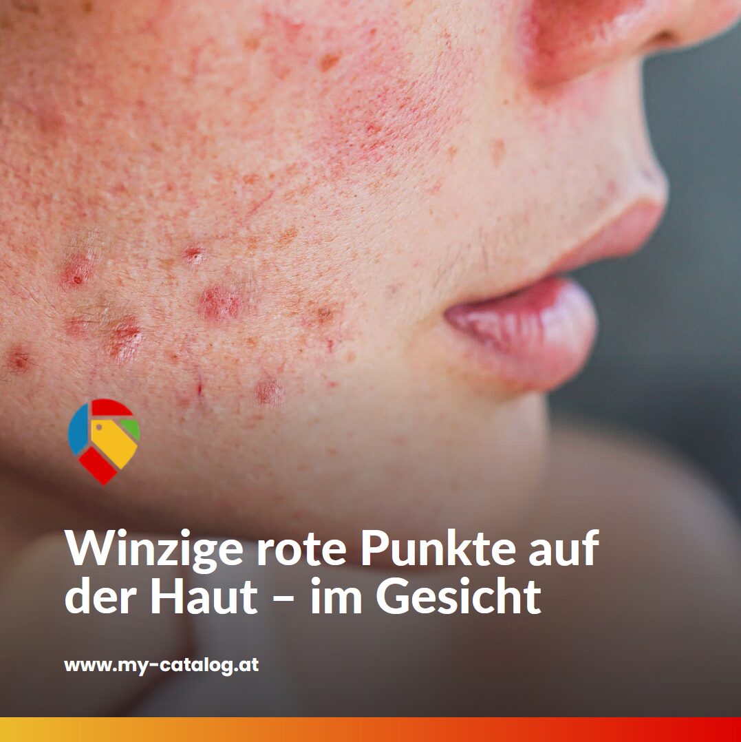 Winzige rote Flecken auf der Haut - im Gesicht Winzige rote Flecken auf der Haut - im Gesicht