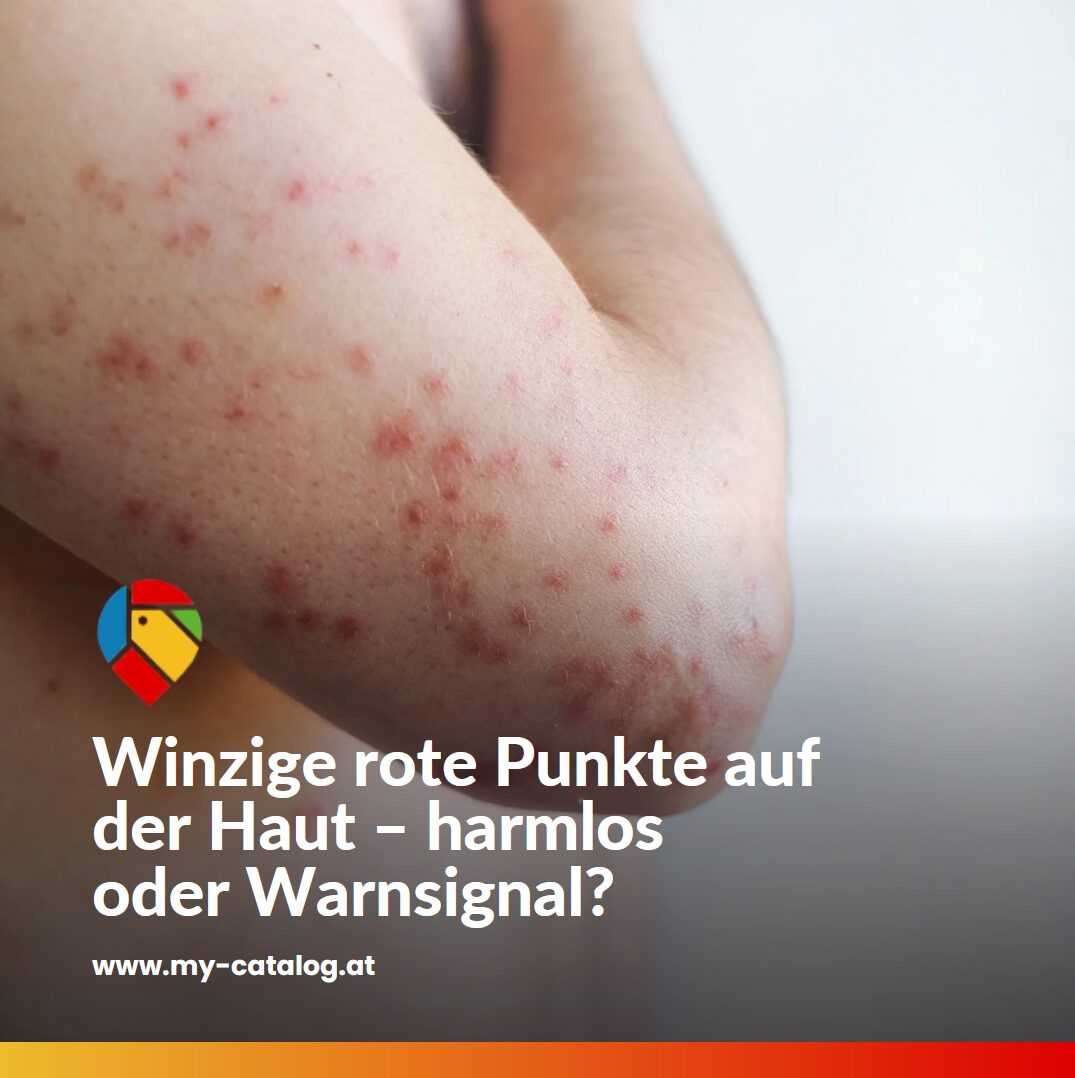 Winzige rote Punkte auf der Haut – harmlos oder Warnsignal? Winzige rote Punkte auf der Haut – harmlos oder Warnsignal?