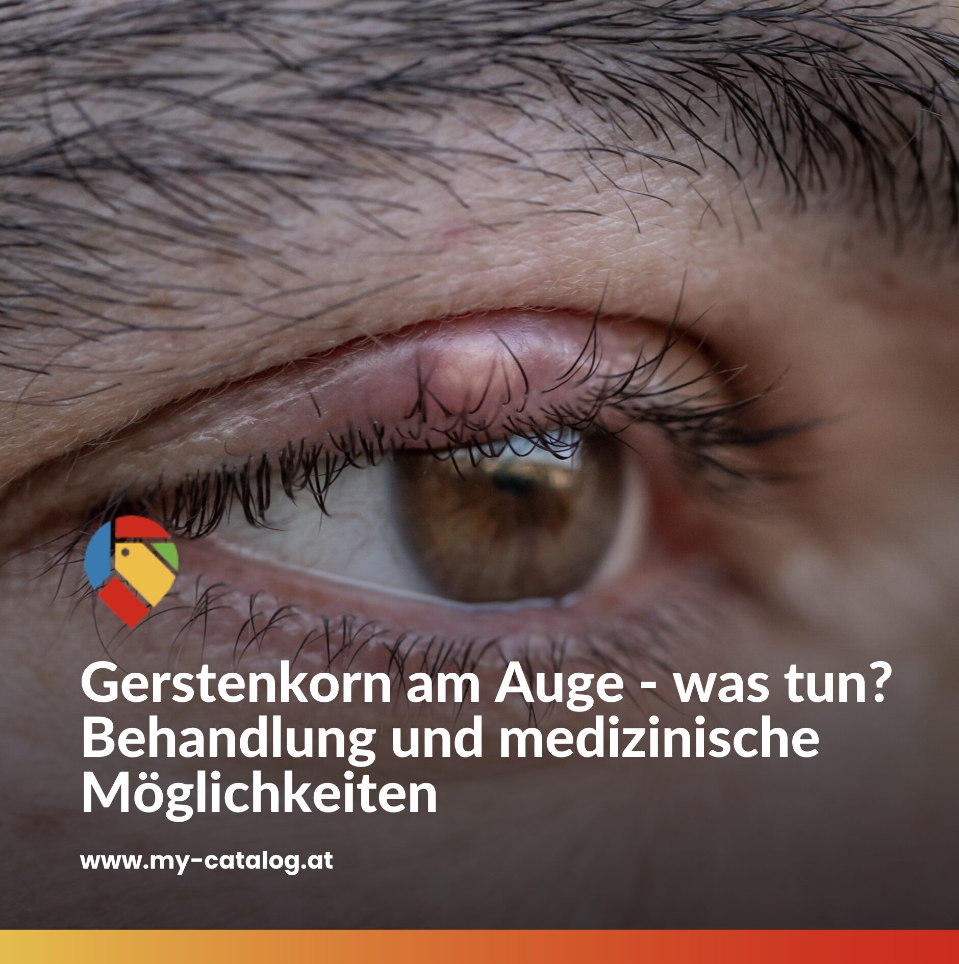 Gerstenkorn am Auge - was tun? Behandlung und medizinische Möglichkeiten Gerstenkorn am Auge - was tun? Behandlung und medizinische Möglichkeiten