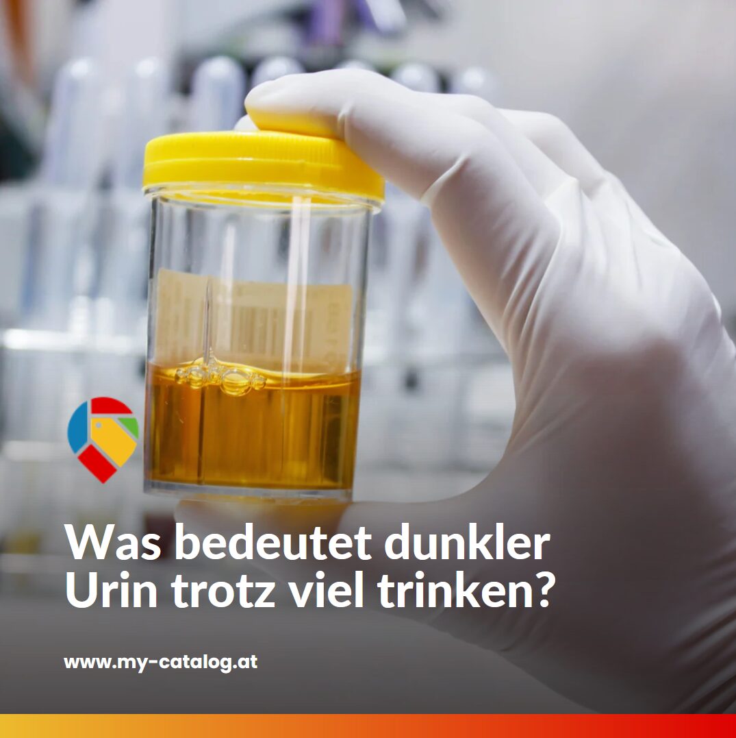 Was bedeutet dunkler Urin trotz viel trinken? Was bedeutet dunkler Urin trotz viel trinken?